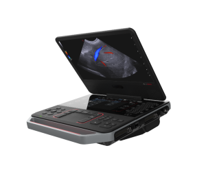 Esaote ultraljud MyLab Heron