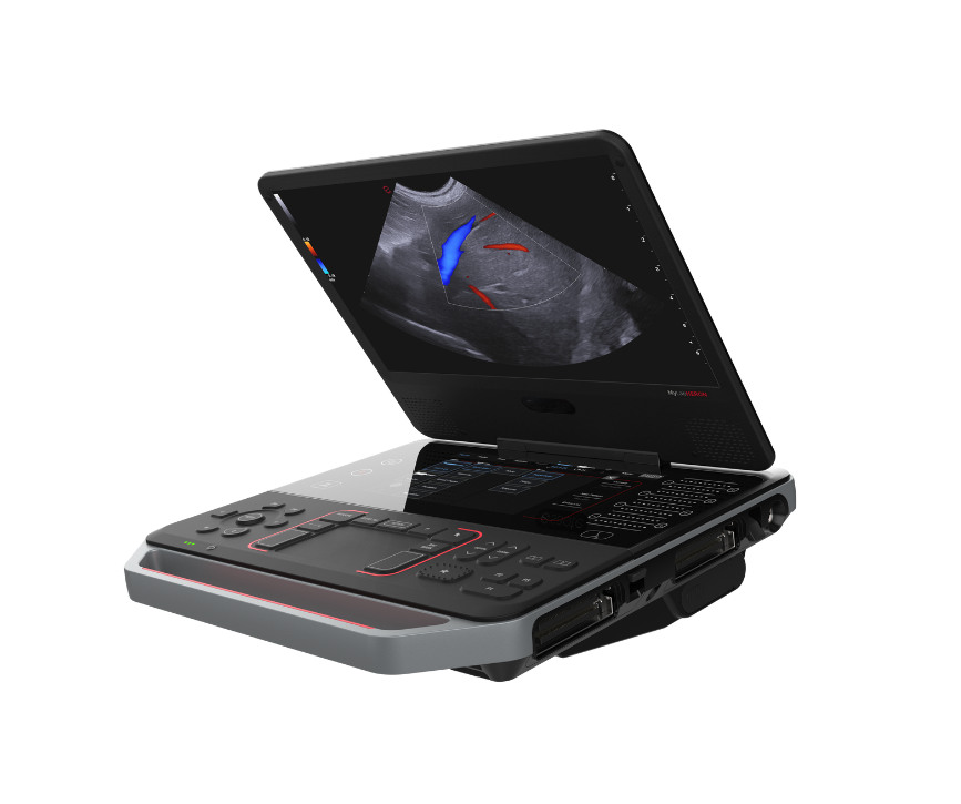 Esaote ultraljud MyLab Heron